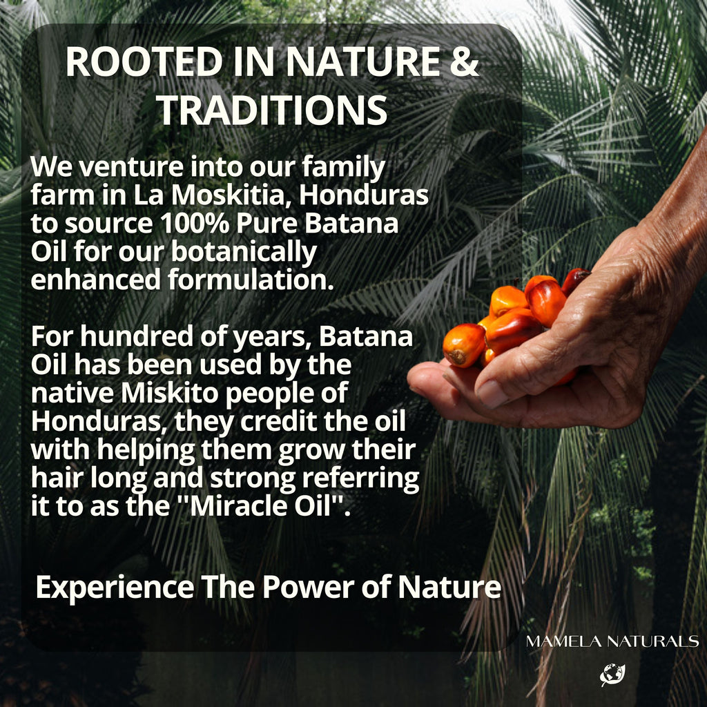 authentic batana oil
real batana oil 
mamela naturals batana oil
botanical hair growth oil
natural hair growth oil
batana hair growth oil
unrefined batana oil

raw batana oil

pure batana oil

organic batana oil

natural hair growth oil

botana oil for hair growth

best batana oil

batna oil

batans oil

Batana oil wholesale

Batana oil supplier

batana oil reviews

batana oil paste

batana oil from Honduras

batana oil for hair growth dr sebi organic

batana oil for hair growth

batana oil for hair

batana